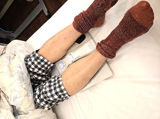 SIXPADを使った電気刺激による筋トレ（透析中ベッド上で実施）