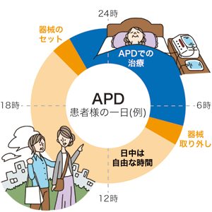 APD（自動腹膜装置）における患者様の1日の流れ（就寝中に装置で自動透析、日中は自由時間）